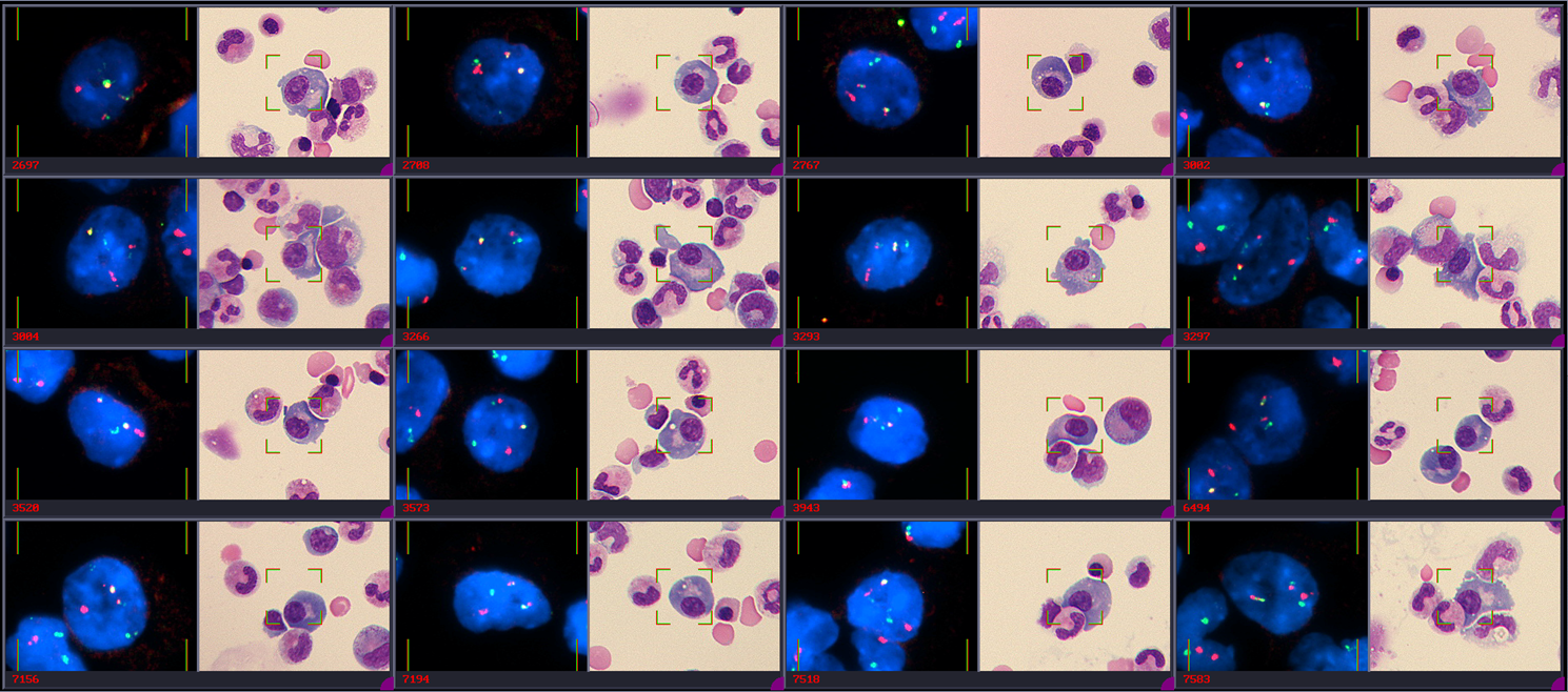 Giemsa-stained plasma cells consecutively hybridized FISH probes