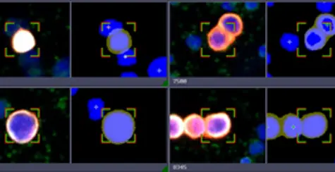 Automated Rare Cell detection