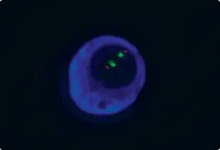 Co-hybridization of immuno-fluorescent antibodies and FISH