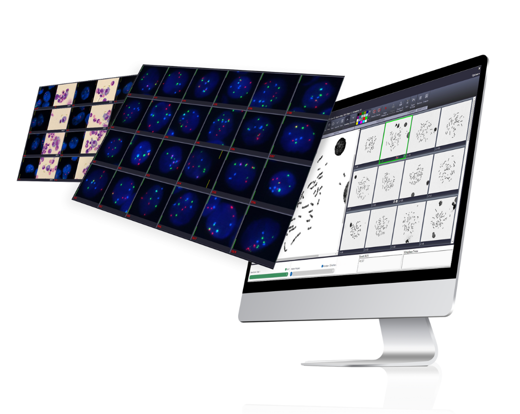BioView metaphases imaging review workstation