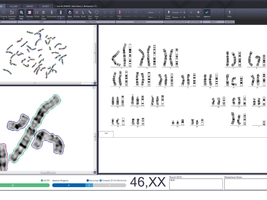 Metaphases Imaging