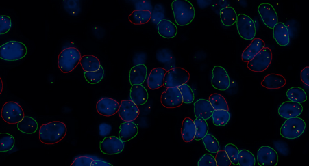FFPE tissue section Hybridized with break apart DNA FISH probes