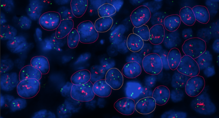 FFPE tissue section hybridized with amplification DNA FISH probes
