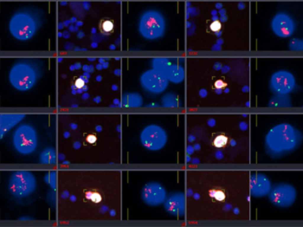 Rare cells detection