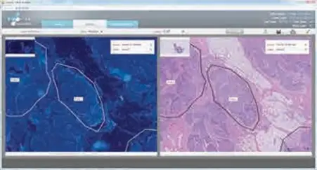 Digital annotation of histology-stained samples and matching with consecutive labelled section