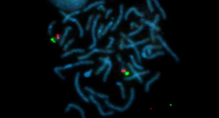 Rapid imaging of fluorescent stained metaphases