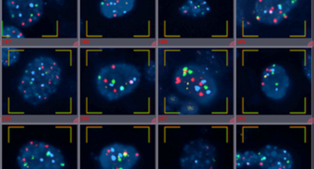 Automated imaging and on-screen gallery presentation of cells in suspension, hybridized with FISH probes